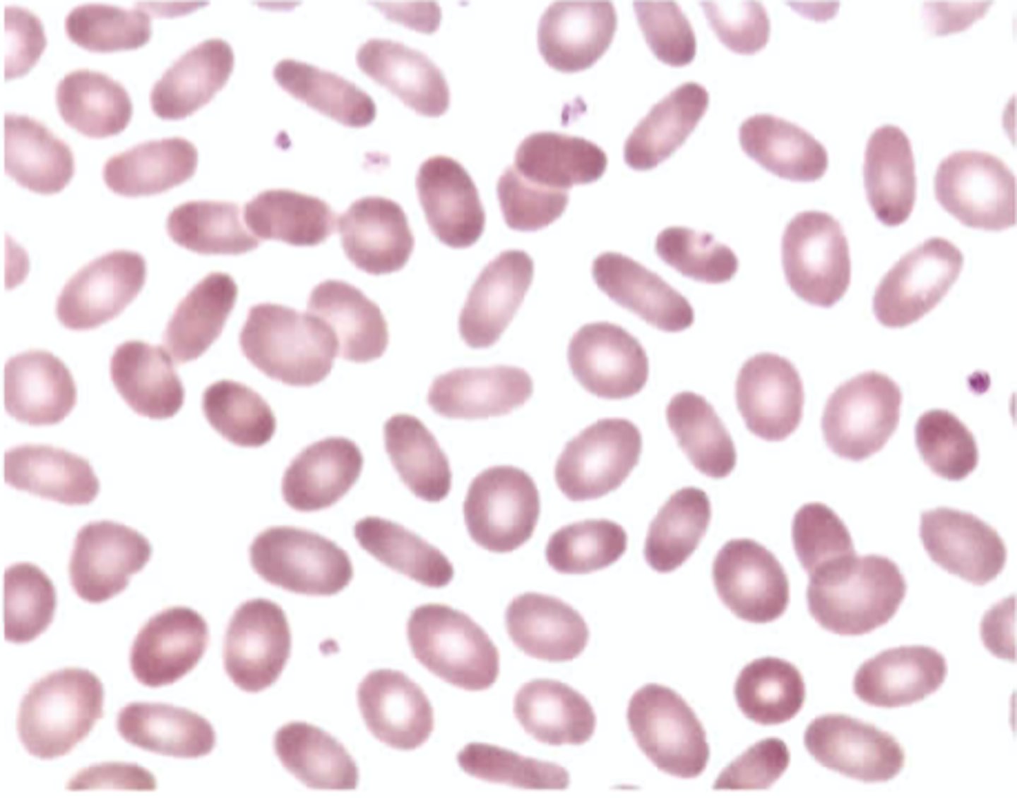 <p>C. An intrinsic hereditary defect of red cells should be suspected.</p>