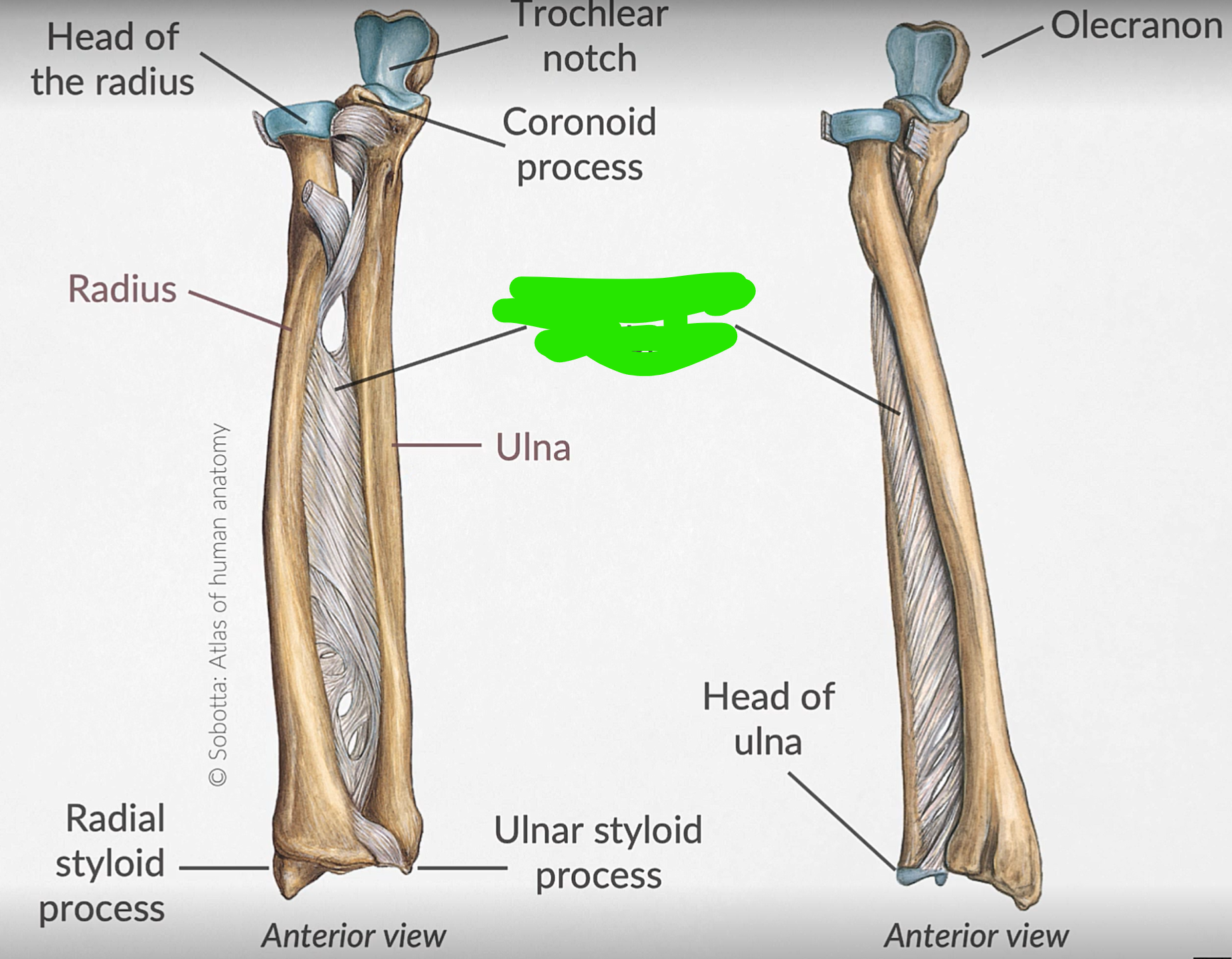 term image