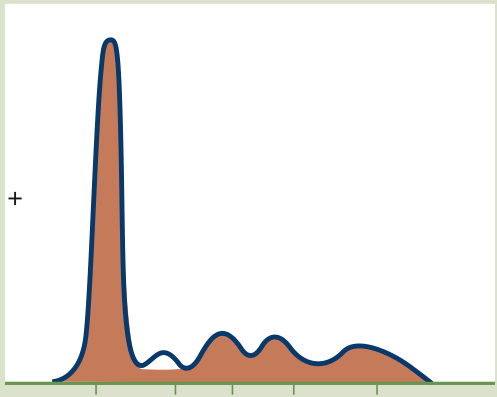 <p>Decreased Alpha 1</p>