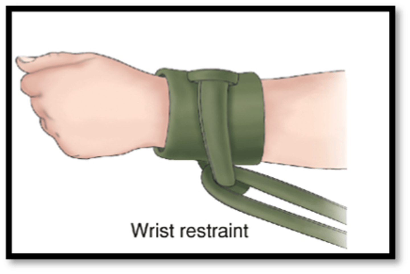 <p>unjustified restraint</p>