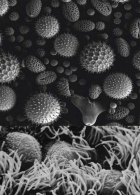 <p>What kind of microscope produces this image?</p>