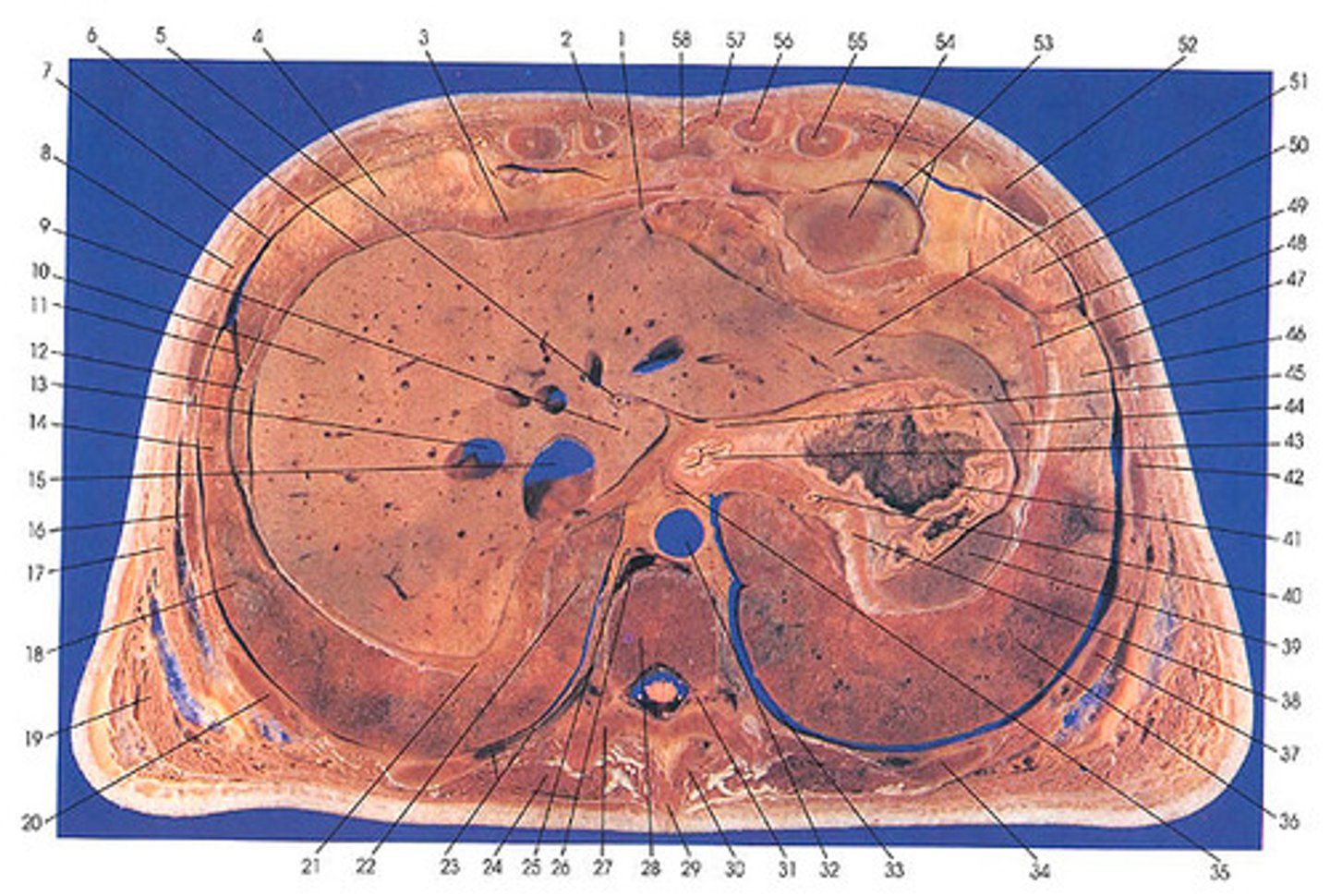 <p>Crossection</p>