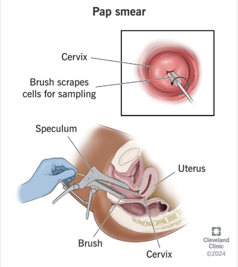 <p>pananicolaou test&nbsp;</p><p>Also known as a Pap smear</p><p><em>Diagnostic Test&nbsp;</em></p>