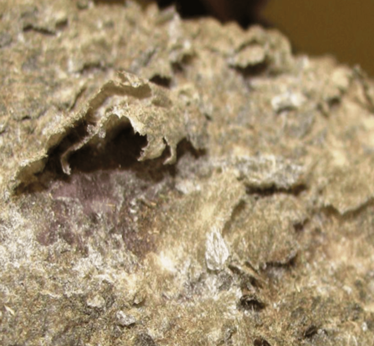 <p>What lesion is this? Is it primary or secondary?</p>