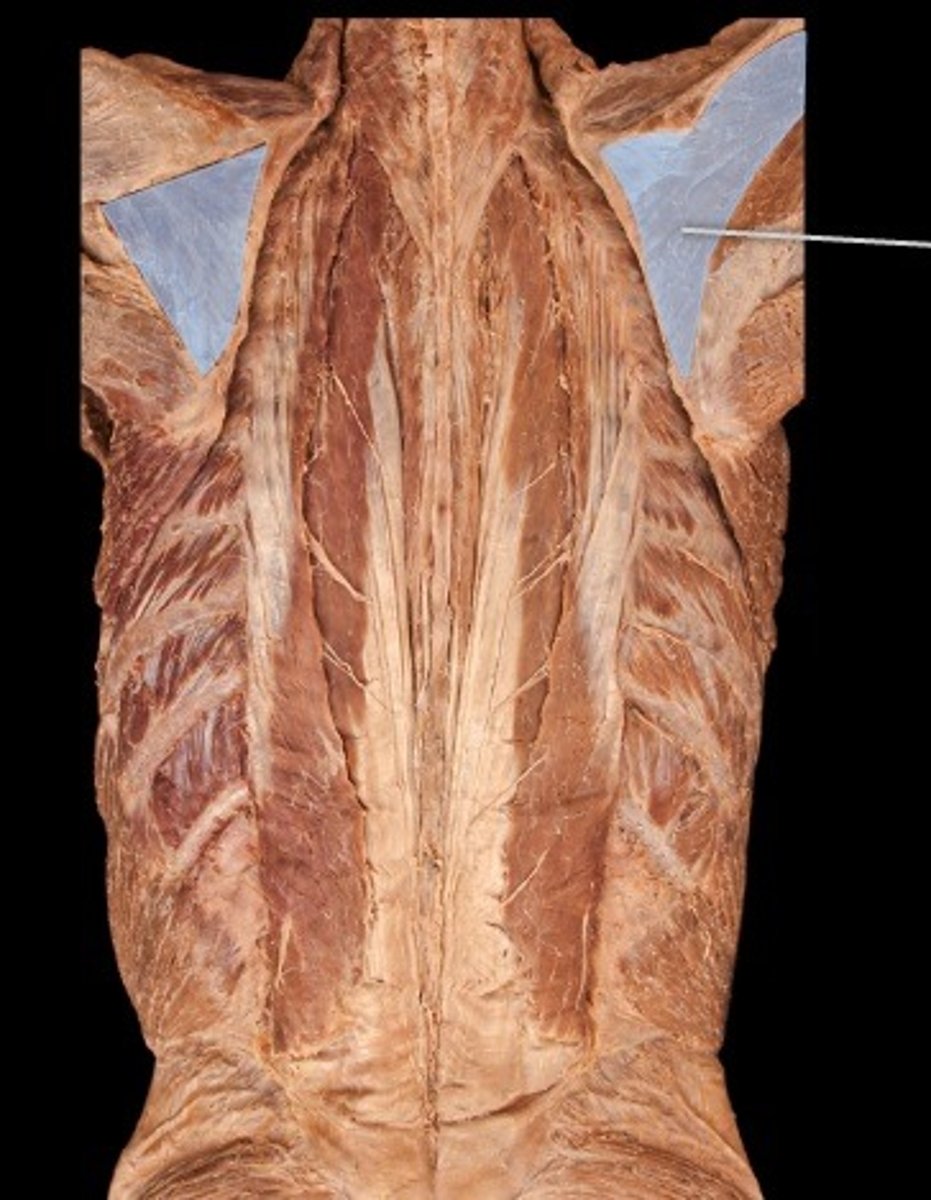 <p>What muscle is this?</p>