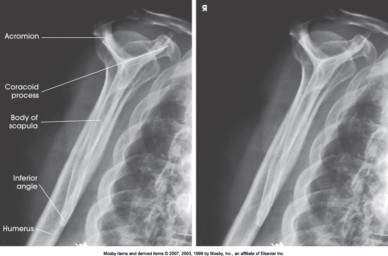 <p>What position is demonstrated?</p>