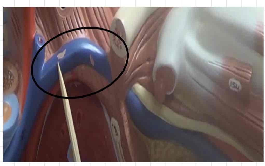 <p>what is this? (torso model)</p>