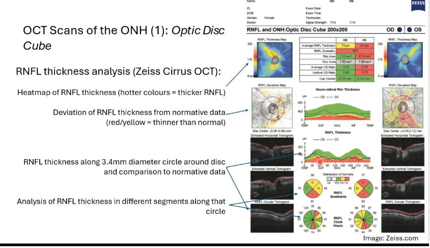 <p>RNFL thickness analysis of the optic disc cube </p>