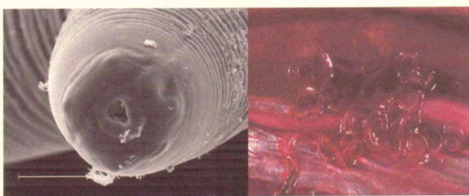 <p>Parasite under microscope </p>
