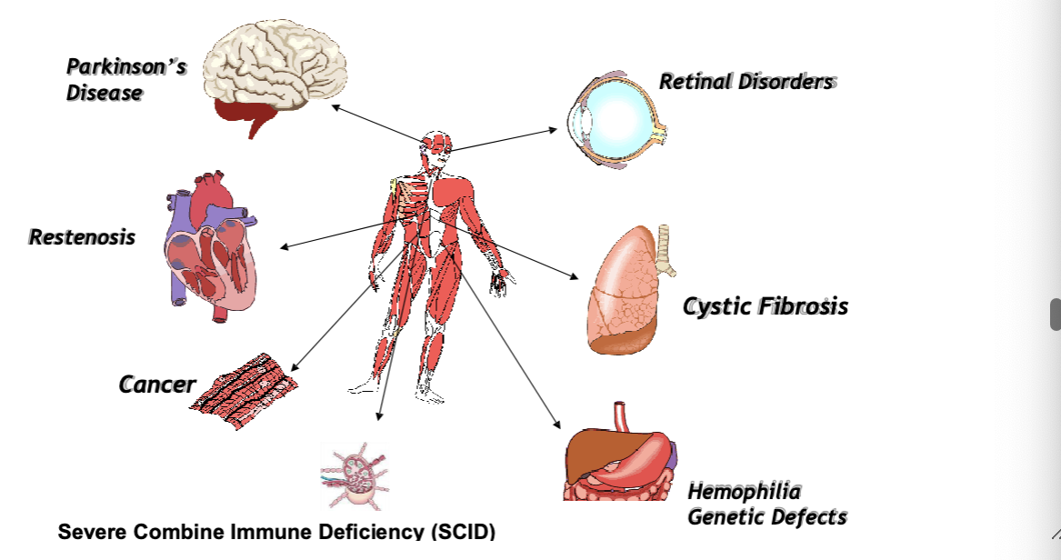 <ul><li><p>parkinsons</p></li><li><p>restenoisis</p></li><li><p>cancer</p></li><li><p>severe combine immune deficiency (SCID) (bubble boy disease)</p></li><li><p>retinal disorders</p></li><li><p>CFR</p></li><li><p>hemophilia genetic defects</p></li></ul><p></p>