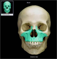 <p>Forms most of the upper jaw, and part of the hard palate, contains upper molars, premolars, and canines</p>