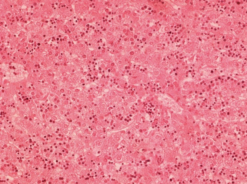 <p><span>Fase esplenohepatica bazo e hígado</span></p>