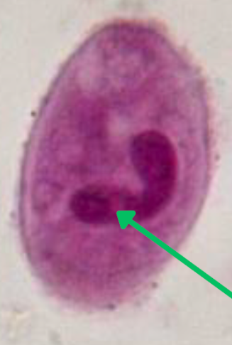 <ul><li><p style="text-align: justify;"><span style="background-color: transparent;"><span>Identify the organism. Give genus and species.</span></span></p><ul><li><p style="text-align: justify;">(1)</p></li></ul></li><li><p style="text-align: justify;"><span style="background-color: transparent;"><span>What is the morphologic stage of the organism?</span></span></p><ul><li><p style="text-align: justify;">(2)</p></li></ul></li><li><p style="text-align: justify;"><span style="background-color: transparent;"><span>What are the structures pointed by the arrow?</span></span></p><ul><li><p style="text-align: justify;">(3)</p></li></ul></li><li><p style="text-align: justify;"><span style="background-color: transparent;"><span>What is the specimen of choice in detecting the organism?</span></span></p><ul><li><p style="text-align: justify;">(4)</p></li></ul></li></ul><p></p>