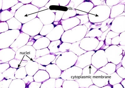 <ul><li><p>loose CT</p></li><li><p>acts as a cushion</p></li><li><p>good insulator, stores fat </p></li><li><p>found in: under skin, around certain joints, around kidneys, behind eyeballs, surface of the heart </p></li></ul><p></p>