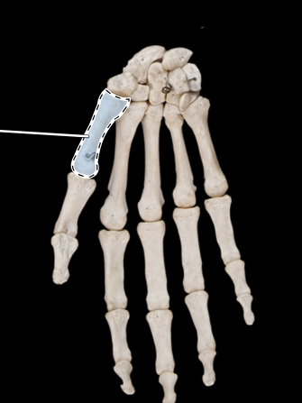 <p>Bones of the hand, anterior view, right side</p>