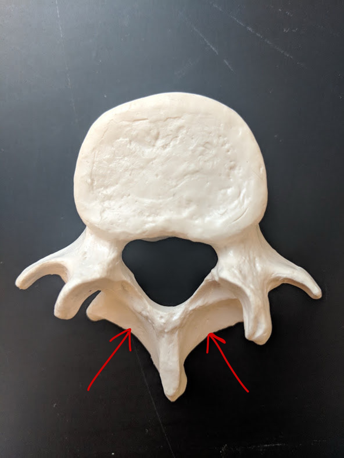 <p>Name this structure</p>