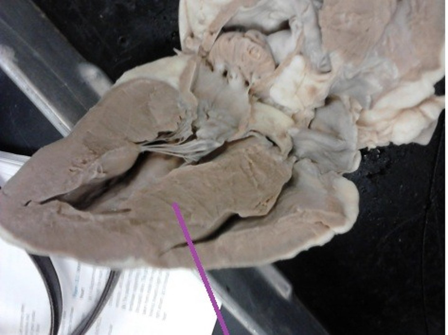 <p>Identify the structure that divides the two ventricles.</p>