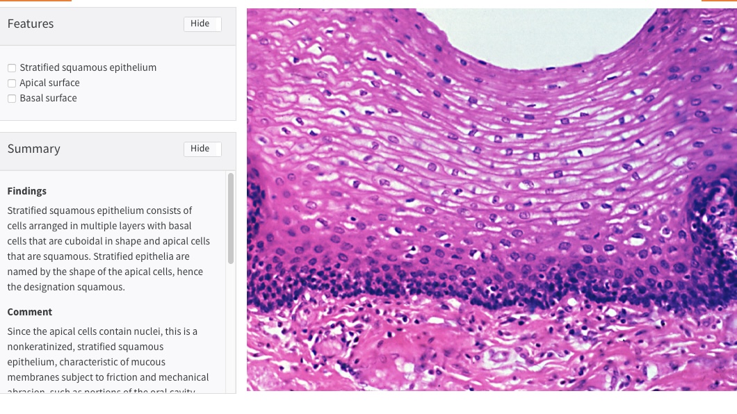 <p>1) stratified squamous epithelium</p><p>2) apical surface</p><p>3) basal surface</p>