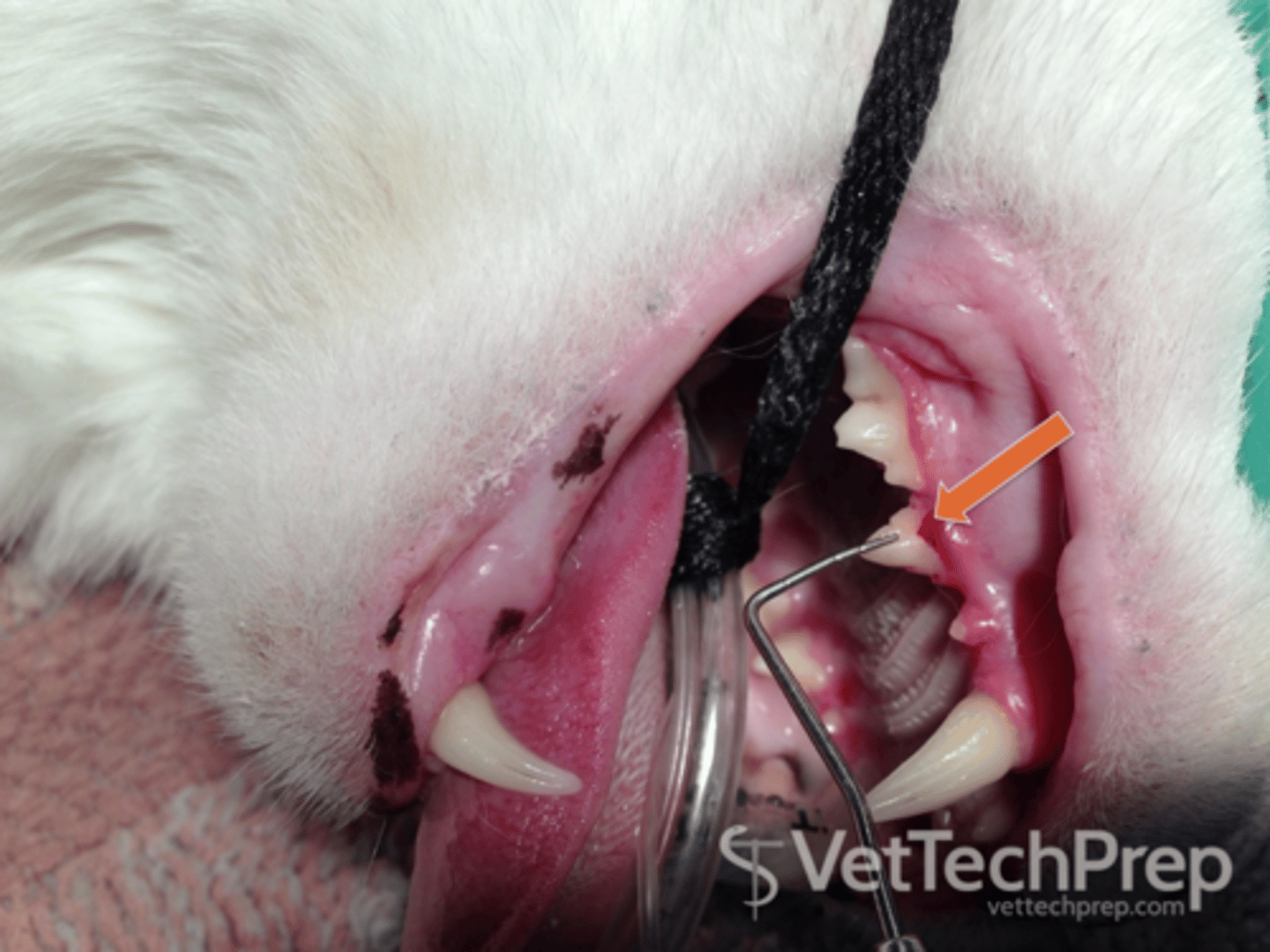 <p>often refered to as a line lesion or resportive lesion. Very painful</p>
