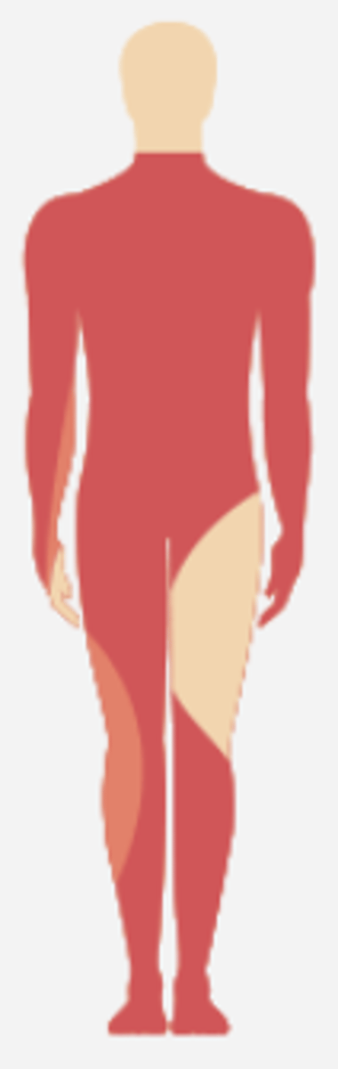 <p>most common neurological level of SCIs</p>