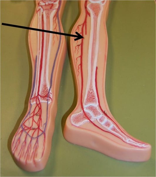 <p>IDENTIFY THIS ARTERY</p>