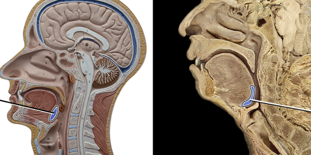 <p>trap foreign material&nbsp;</p>