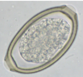 <p>sinus worm of dogs</p>