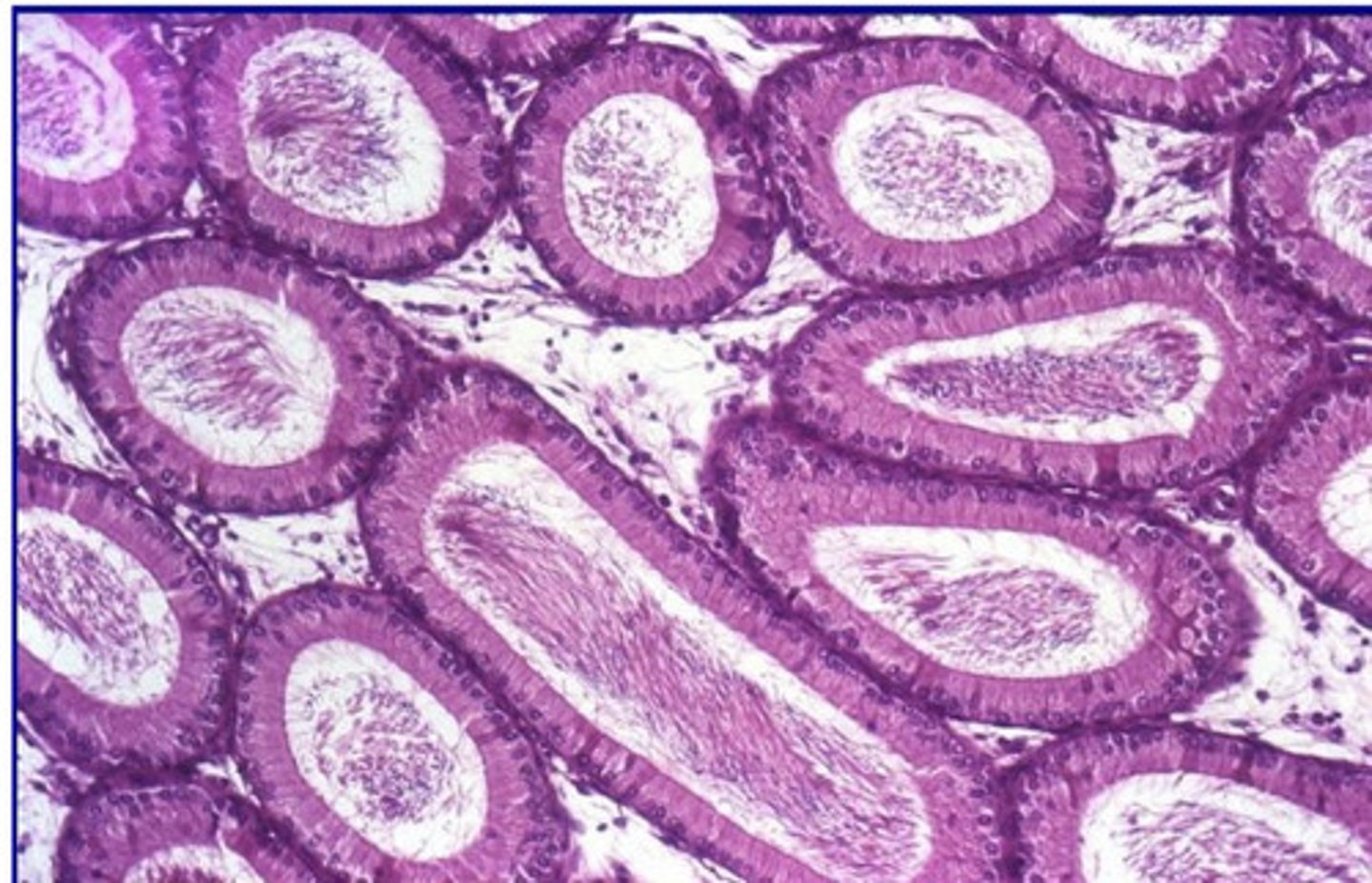 <p>describe the histological morphology of the epididymis</p>