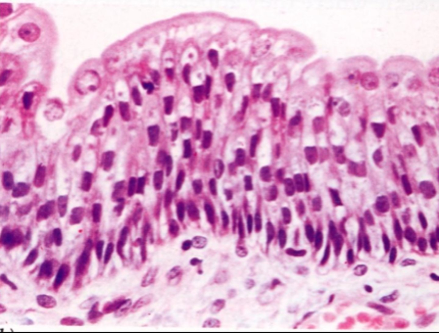 <p>What type of epithelial tissue is this?</p>
