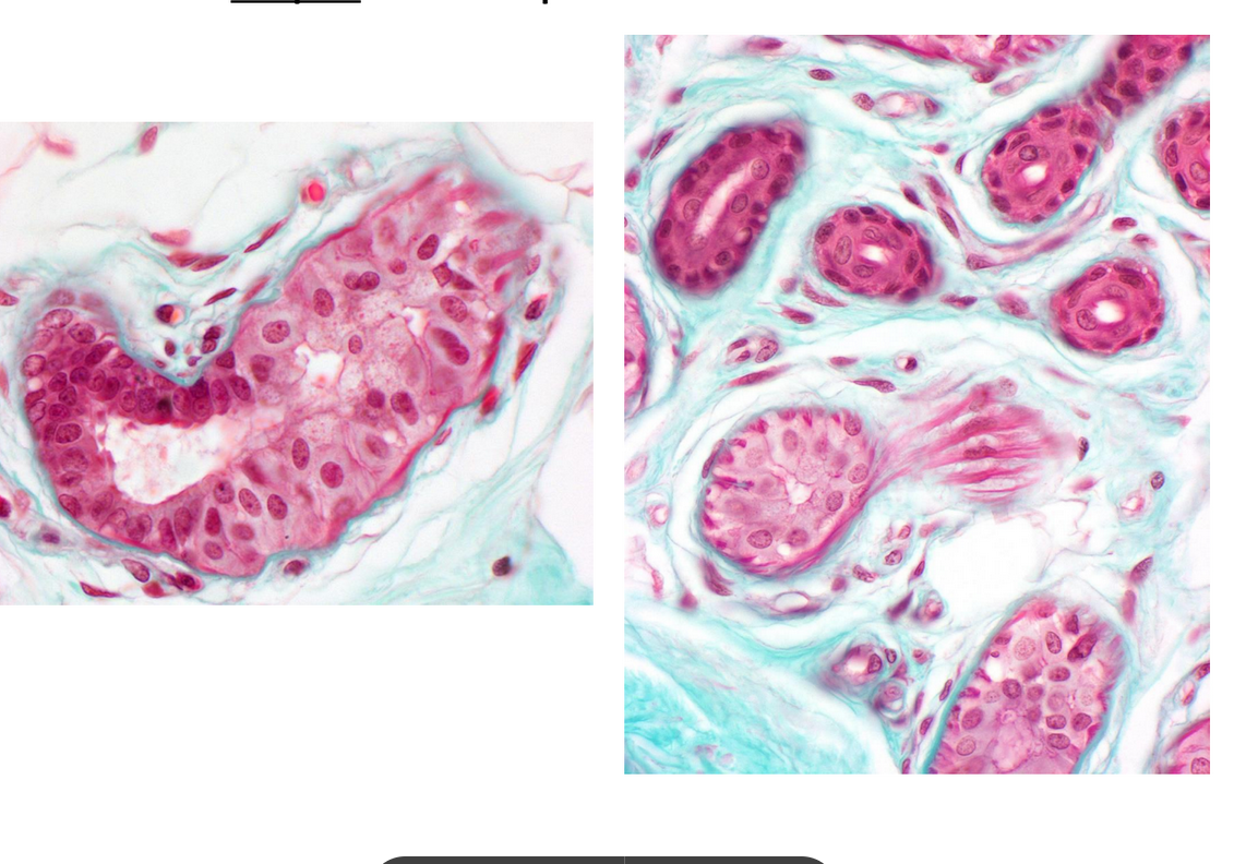 <p>glande sudoripare eccrine</p>