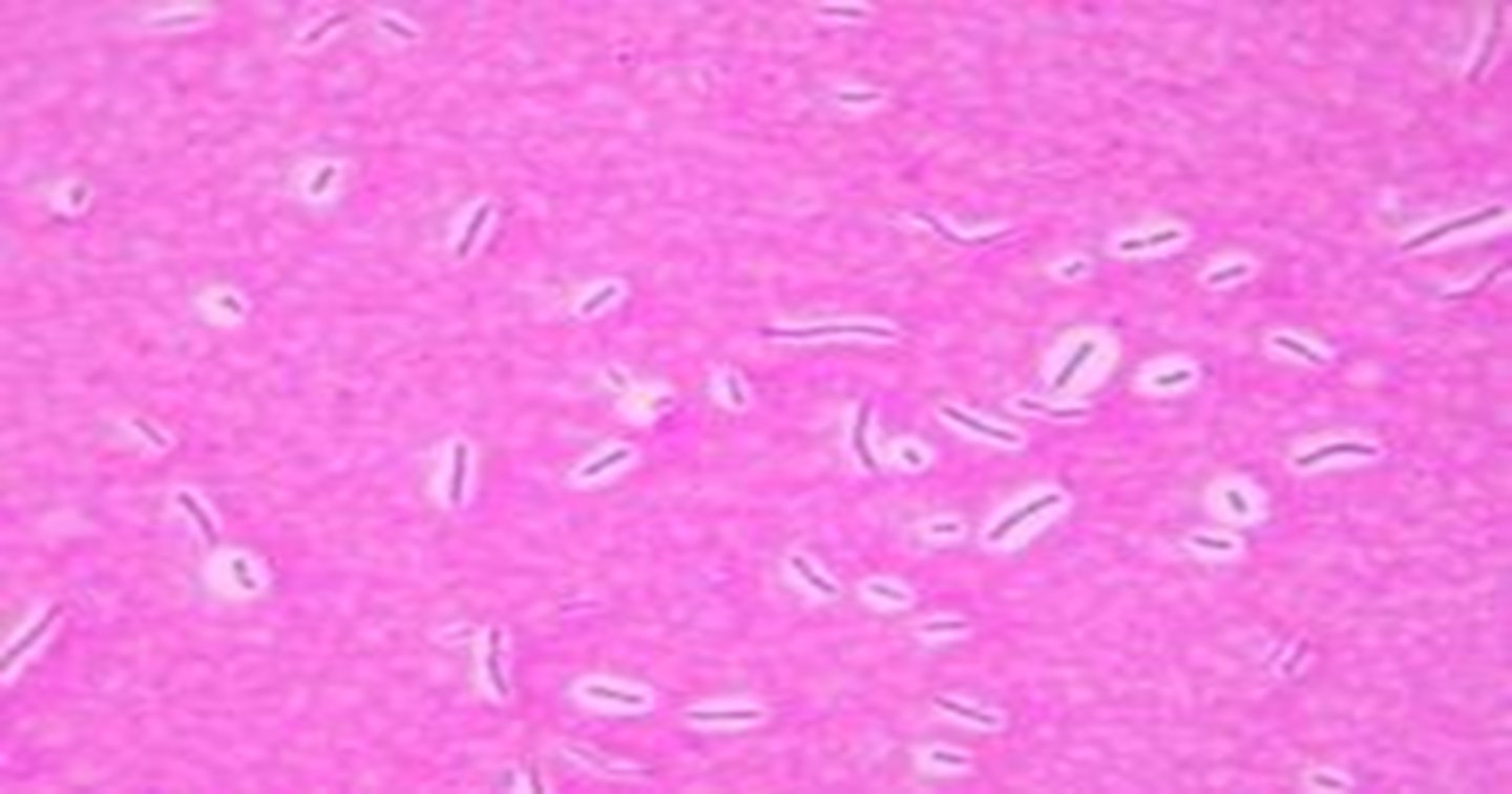 <p>- capsule is the clear area in between the stained cell and the stained background</p><p>- best way to visualize capsules is by combining a negative stain and a positive stain</p>