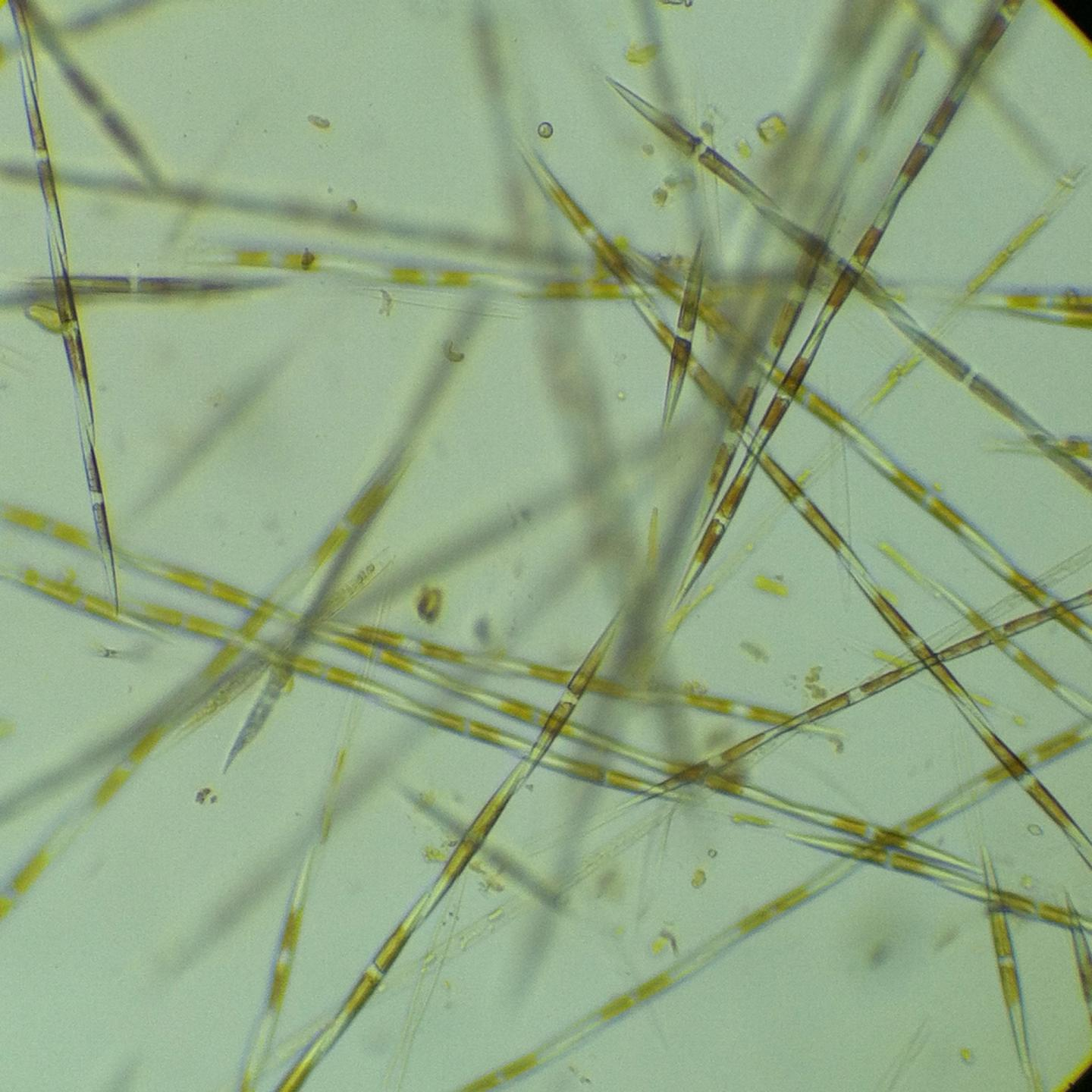 <ul><li><p>Diatom</p></li><li><p>produces domoic acid: causes loss of short term memory and GI symptoms in humans</p></li></ul><p></p>