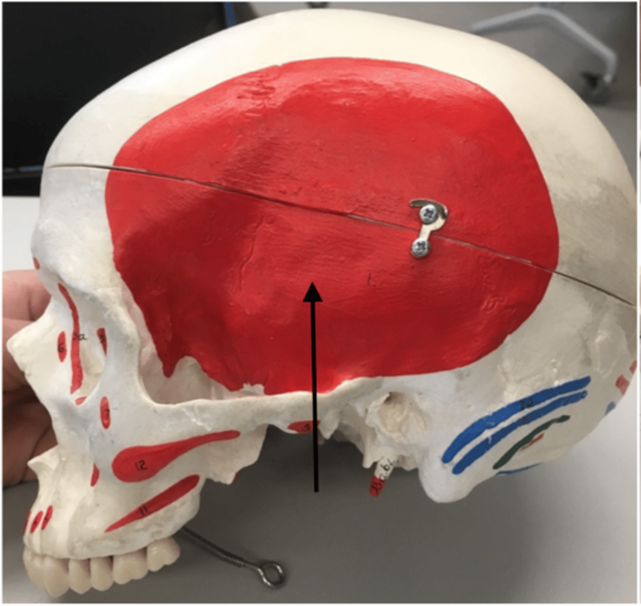 <p>1</p><p>O: Lateral skull</p>