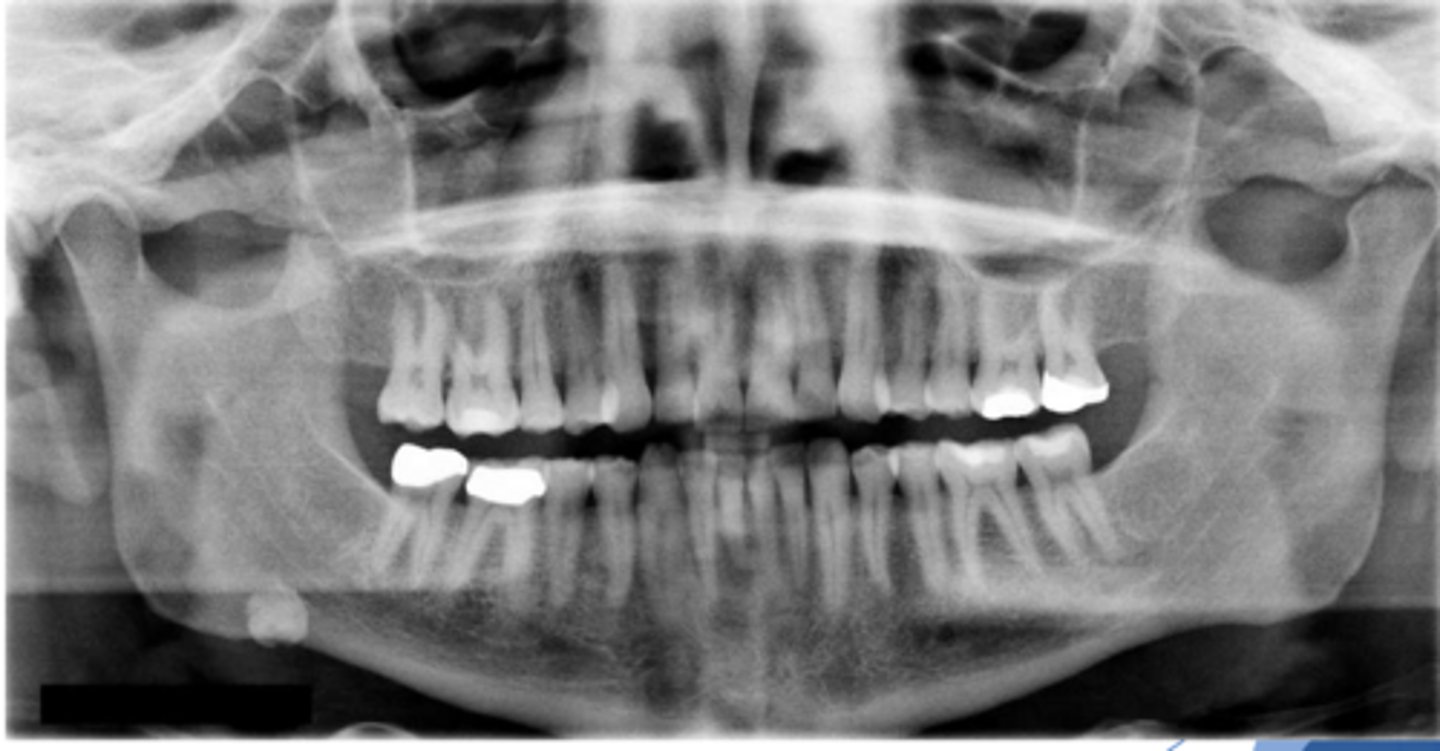 <p>ID the pathology:</p>
