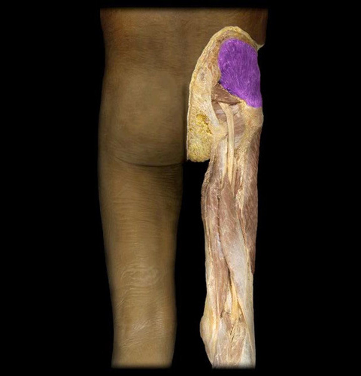 <p>Name This Muscle</p>