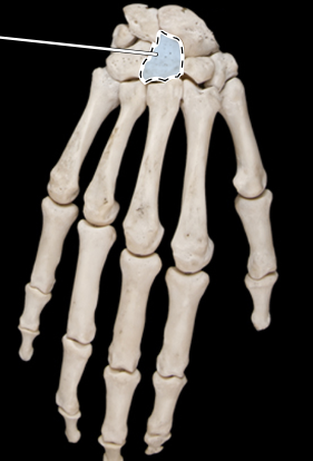 <p>Bones of the hand, posterior view, right side</p>