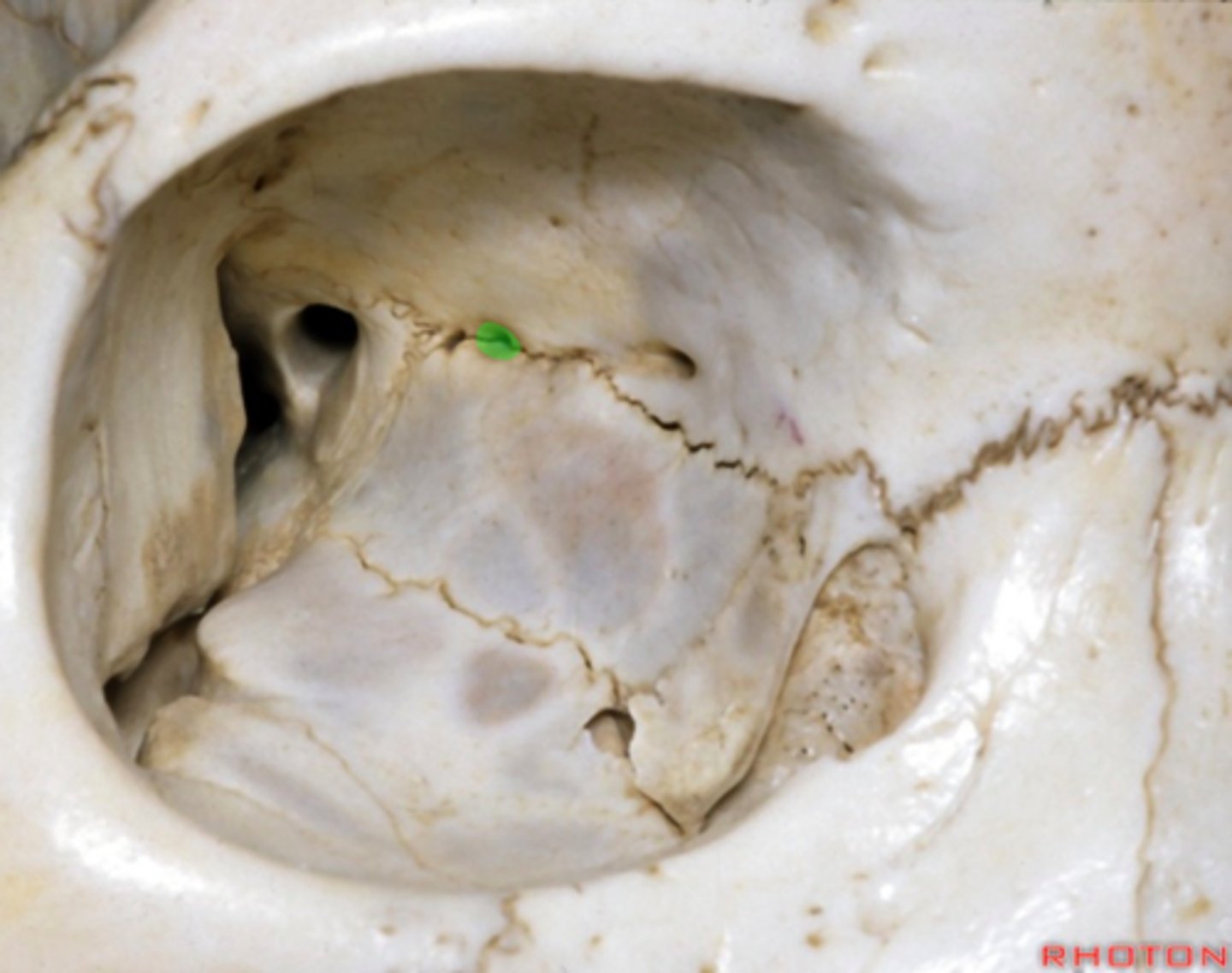 <p>Opening for nerves and vessels at the back.</p>
