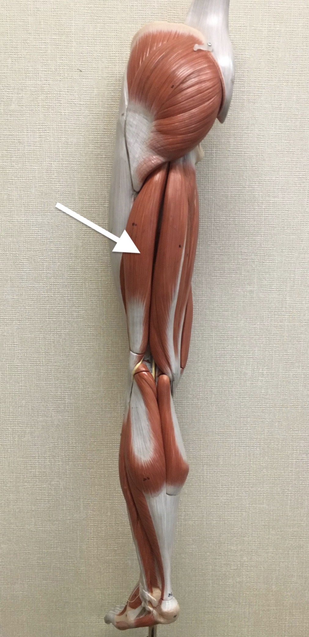 <p><span>Name the muscle AND the head labeled with the white arrow below:</span></p>