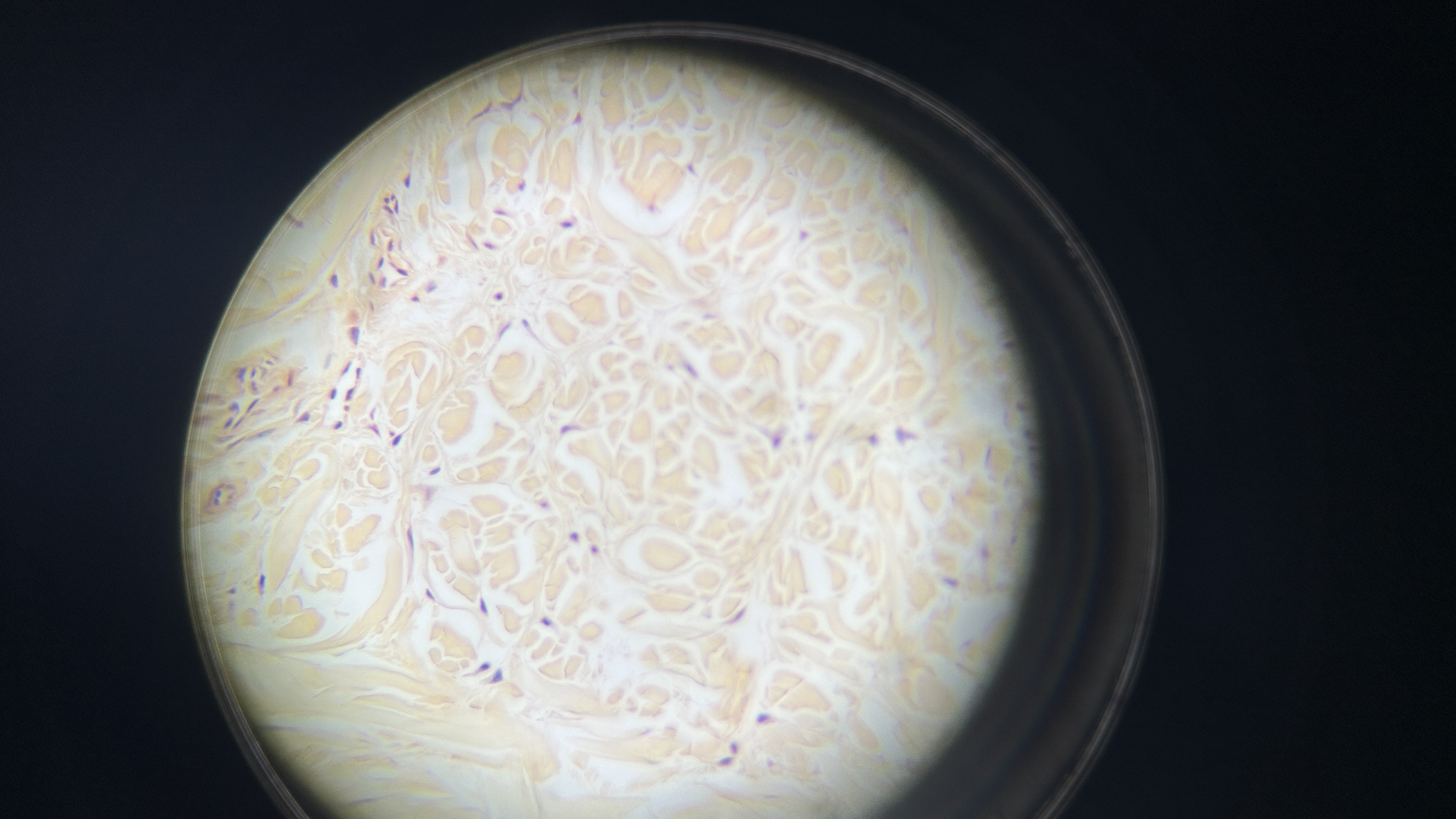 <p>What is the magnification level of the Dense Irregular CT?</p>