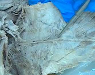 <p>The nerve that innervates the trapezius muscle.</p>