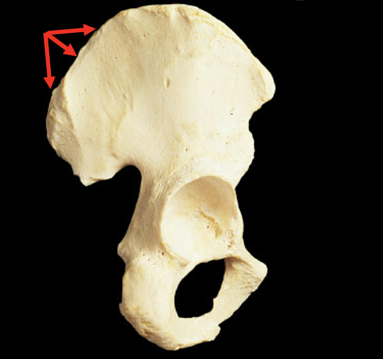Name this region of the pelvis