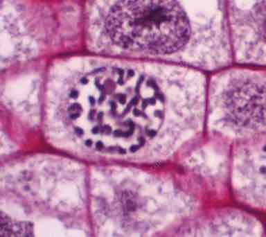 <p>What phase is this cell in?</p>