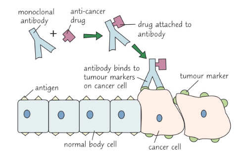 <ol><li><p>Cancer cells have specific antigens called tumour makers</p></li><li><p>Monoclonal antibodies can be produced to bind specifically to tumour markers</p></li><li><p>An anti-cancer drug will be attached to these antibodies which may be a radioactive substance, a toxic drug or a chemical that stops cancer from growing + dividing</p></li><li><p>The antibodies are given to a patient via a drip</p></li><li><p>The drug attached to the antibodies will then attach to the tumour marker + this will kill the cancer cells but not normal body cells</p></li></ol>