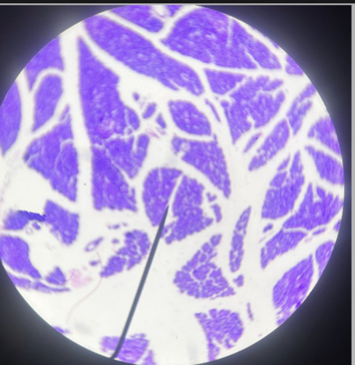 <p>what hormone does this gland secrete?</p>