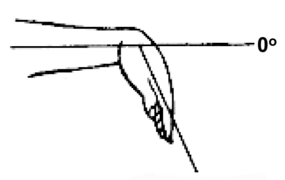 <p>Wrist palmar-flexion</p>