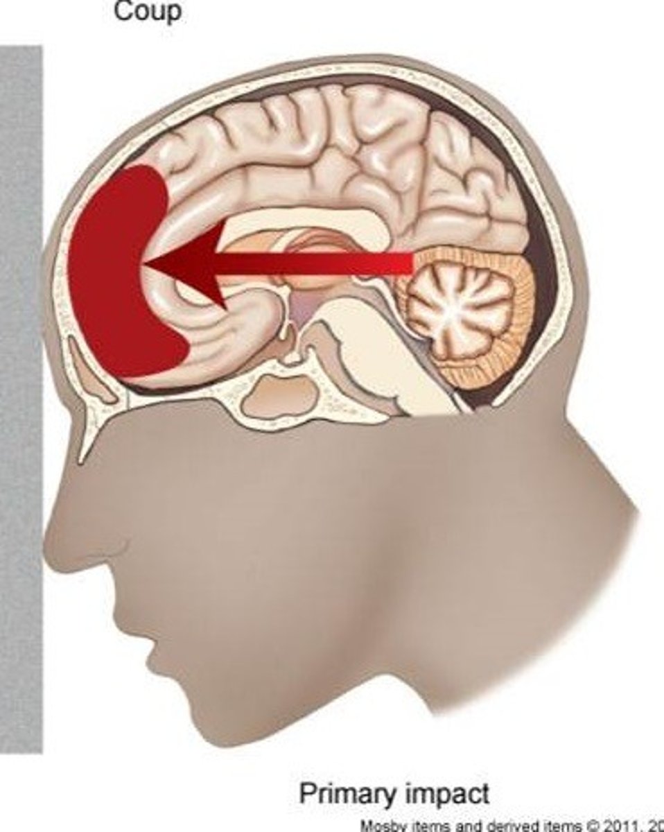 <p>specific, local observable lesions. Includes contusions and hematomas.</p>