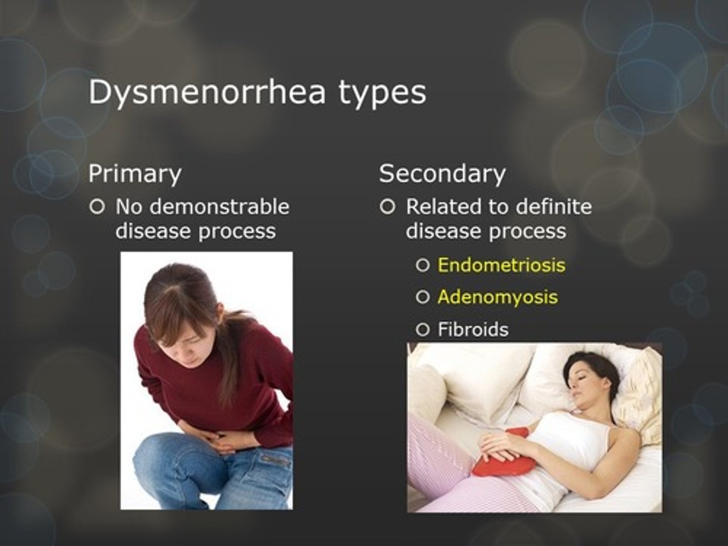 <p>Primary dysmenorrhea</p>