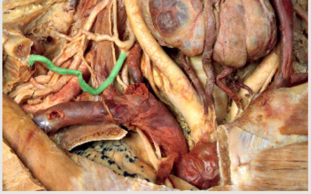 <p>Which artery?</p>