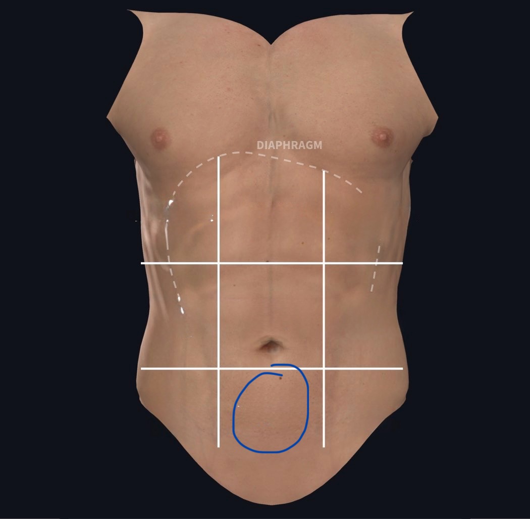 term image