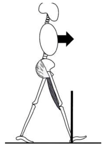 -hip 30º flexion
-thigh: 20º flexion
-pelvis: 10º anterior tilt (neutral)